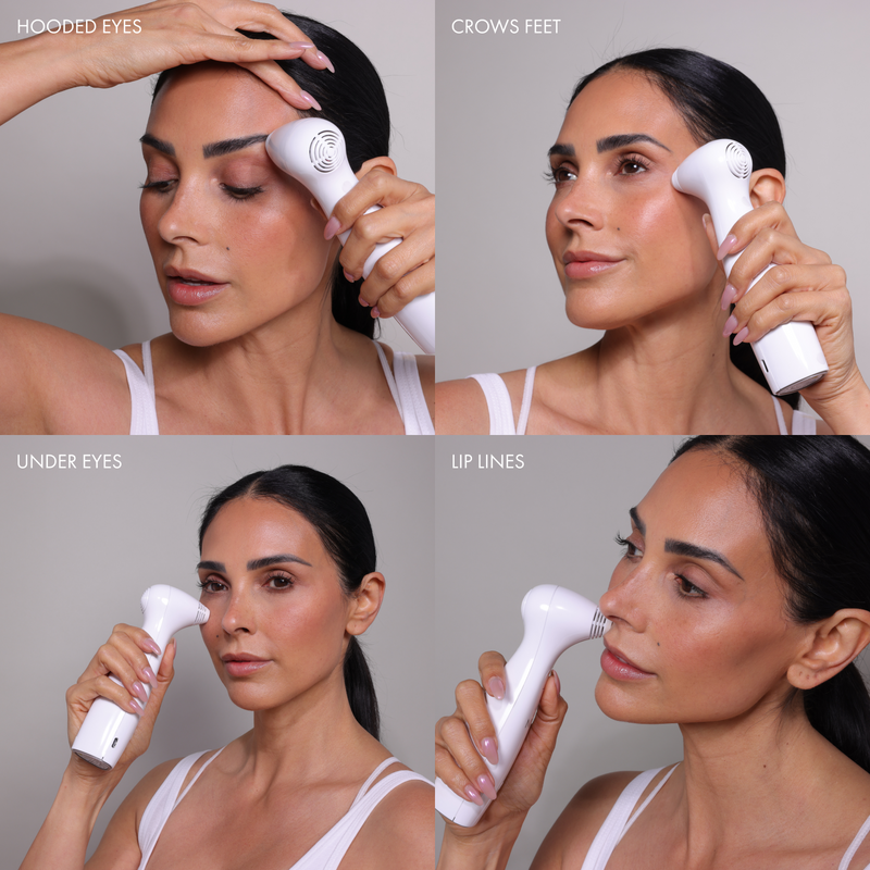 Load image into Gallery viewer, NIRA Pro 3 Laser & Skincare Bundle