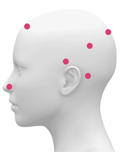 Load image into Gallery viewer, Neuradiant 1070nm Infrared Light Photobiomodulation Helmet with 256 LEDs and 4 - Quadrant Control
